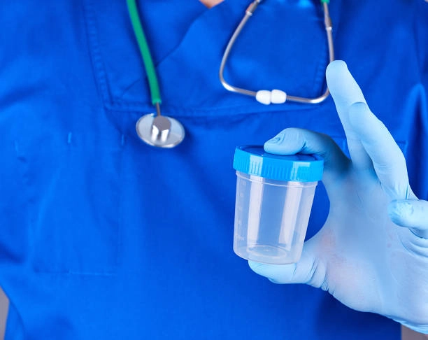 How Drug Test Cups Are Improving Healthcare