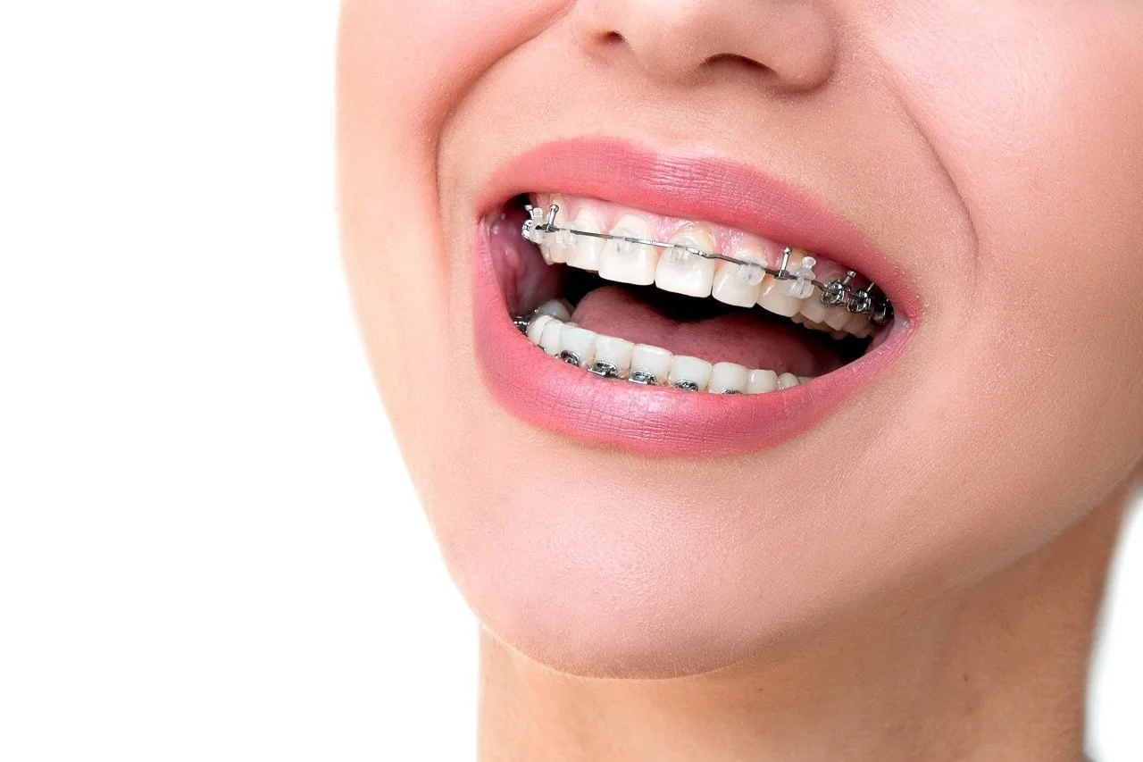 Secrets to Thriving in the World of Corporate Orthodontics Health